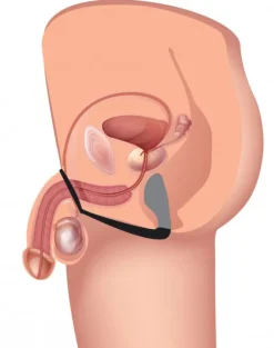 Prostatic Play Prostate Massagers | Penis Rings><noscript><img width=