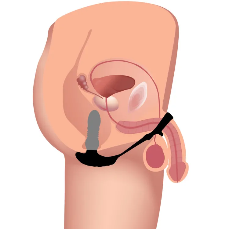 Thunderplugs Unique Anal Toys | Butt Plugs>Remote Thrusting Vibrator with C&B Ring