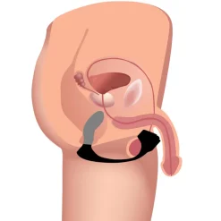 Trinity Vibes Unique Anal Toys | Prostate Massagers>7X Silicone Prostate Plug with Ball Stretcher and Remote